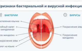 Если в горле запершило: обзор препаратов и народных рецептов