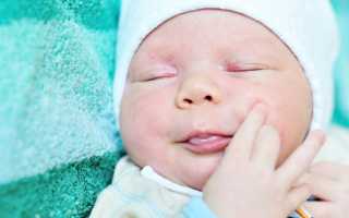 Почему у новорожденных появляются пигментные родимые пятна: причины и виды пятен на лице и теле грудничка
