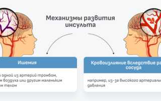 Восстановление после инсульта: как вернуть когнитивные и двигательные функции, зрение и моторику