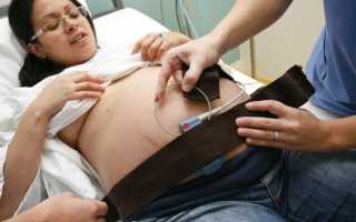 Катетер Фолея перед родами для раскрытия шейки матки: показания, виды и размеры