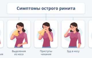 Как выбрать спрей от насморка и заложенности носа: рейтинг лучших средств