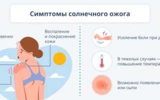 Чем лечить солнечные ожоги: лекарства и народные средства