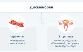 Как избавиться от менструальной боли: домашние методы и лекарства