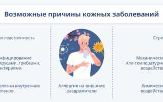 Распространенные заболевания кожи: симптомы и особенности лечения