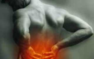 Симптомы и лечение спондилолистеза поясницы