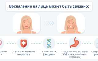 Проблемная кожа лица: причины, лечение и уход