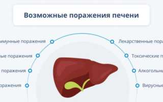 Поражение печени: виды и причины, симптомы и лечение