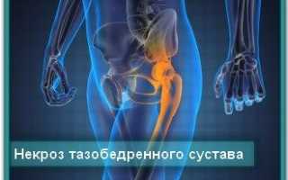 Лечение некроза тазобедренного сустава