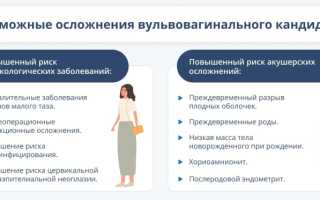 Профилактика кандидоза: когда болезнь легче предупредить