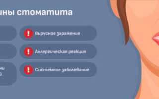 Стоматит во всех его проявлениях: причины и лечение воспаления полости рта