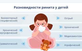 Ринит у детей: разновидности и лечение