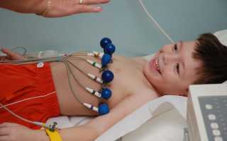 Расшифровка результатов ЭКГ у ребенка: нормы показателей и причины нарушений