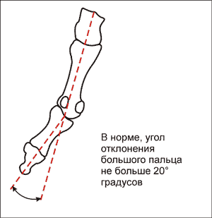 Ось большого пальца