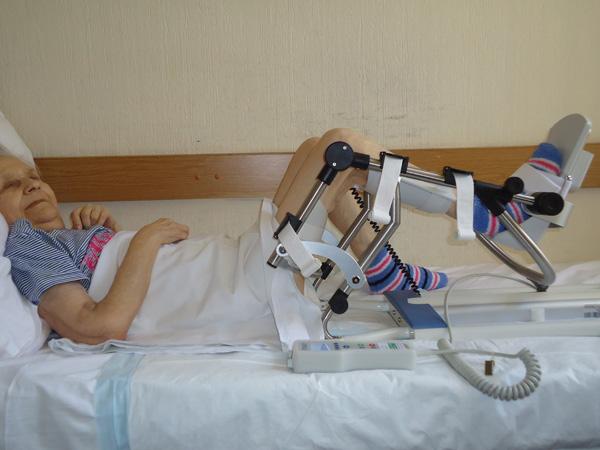 Искусственный коленный сустав