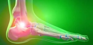 артрозо-артрит стопы артрозо-артрит стопы