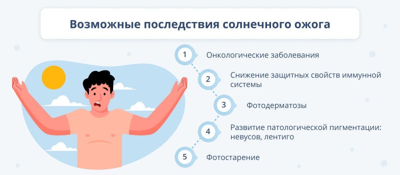 Чем лечить солнечные ожоги: лекарства и народные средства