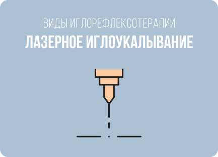 Что и как лечат с помощью иглоукалывания: болезни, показания и противопоказания