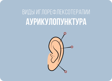 Что и как лечат с помощью иглоукалывания: болезни, показания и противопоказания