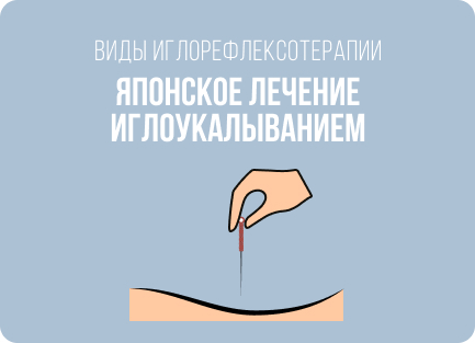 Что и как лечат с помощью иглоукалывания: болезни, показания и противопоказания