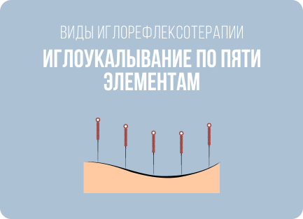 Что и как лечат с помощью иглоукалывания: болезни, показания и противопоказания