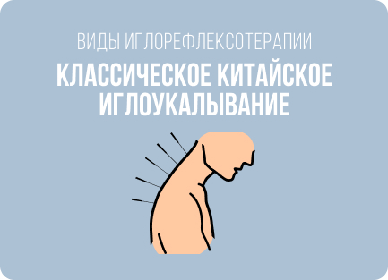 Что и как лечат с помощью иглоукалывания: болезни, показания и противопоказания