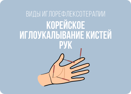 Что и как лечат с помощью иглоукалывания: болезни, показания и противопоказания