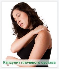 капсулит плечевого сустава капсулит плечевого сустава