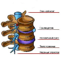 межпозвоночные диски