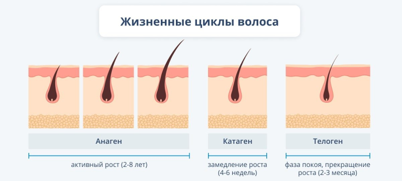 Облысение у мужчин: что нужно делать, если выпадают волосы decoding=