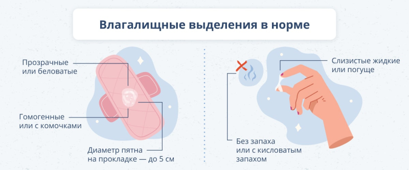 Почему бывают выделения из влагалища и что делать при патологии?