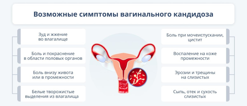 Почему возникает и как проявляется кандидоз у женщин decoding=