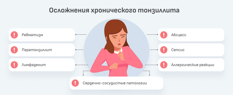 Тонзиллит: признаки, терапия и профилактика