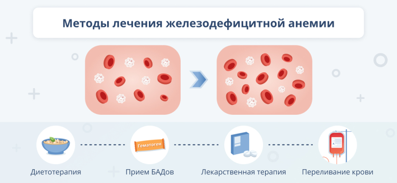 Железодефицитная анемия: симптомы, причины и лечение
