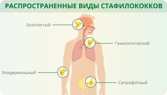 ЗППП и ИППП у мужчин и женщин