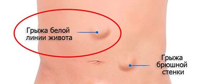 gryzha-beloj-linii-zhivota_cr