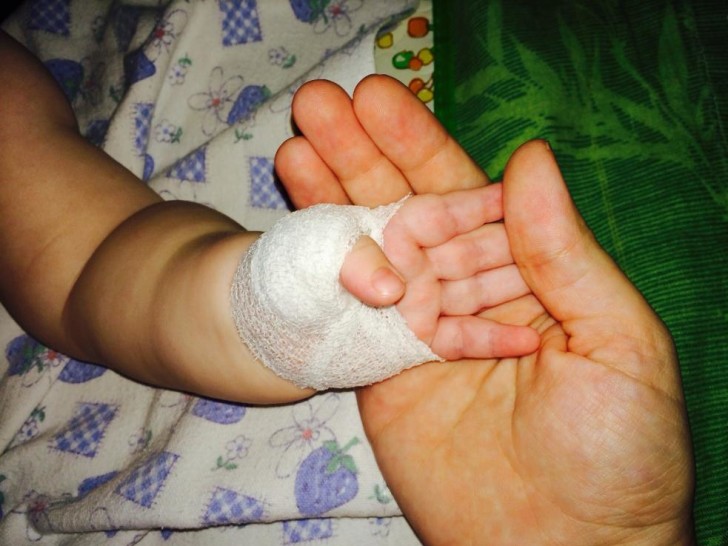 Марлевая повязка Марлевая повязка