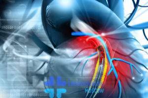 Операция коронарография